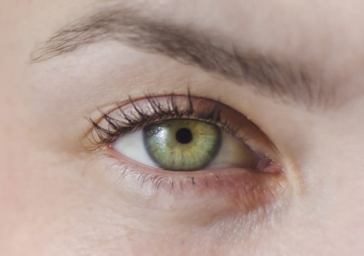 How rare are green eyes?